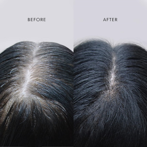 Akemi Revive review before and after